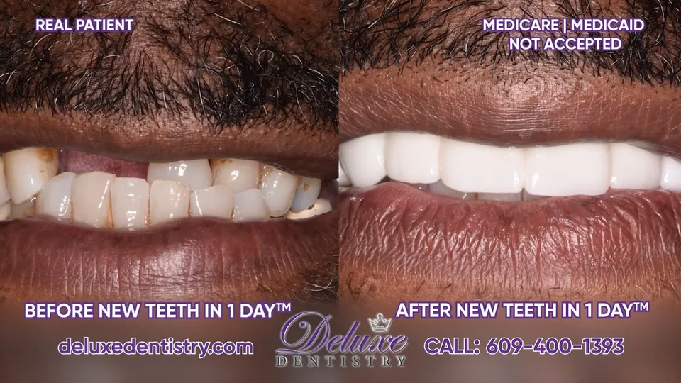 Video thumbnail: Before and After! Kirby Speaks About His Dental Implants